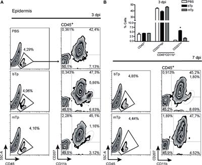 Early Immune Response Elicited by Different Trypanosoma cruzi Infective Stages